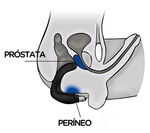 MV012 1 800x800a - Como usar estimulador de próstata