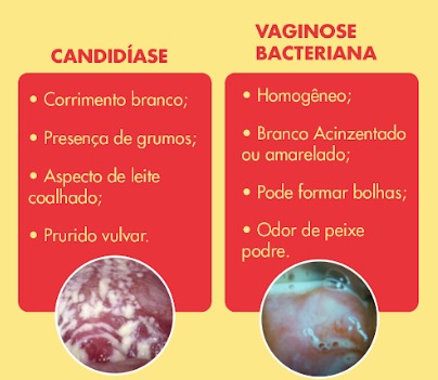 Hotpepper vaginose candidiase - Odor vaginal: É candidíase ou vaginose bacteriana?